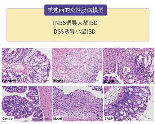 AG真人国际的炎症性肠病模型